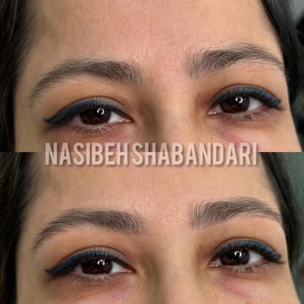 نمونه کار اصلاح ابرو